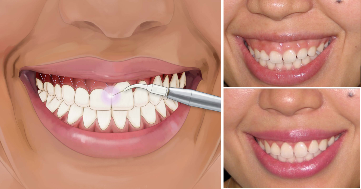 Dental cosmetic studio - αισθητική οδοντιατρική